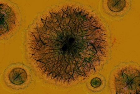 Virus